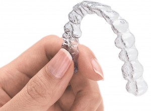 Why Invisalign Is the Right Choice