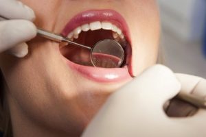 How Often Should You See a Dental Hygienist