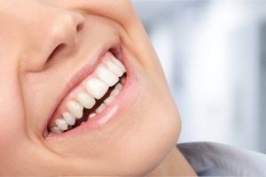 Why Straight Teeth Are Important