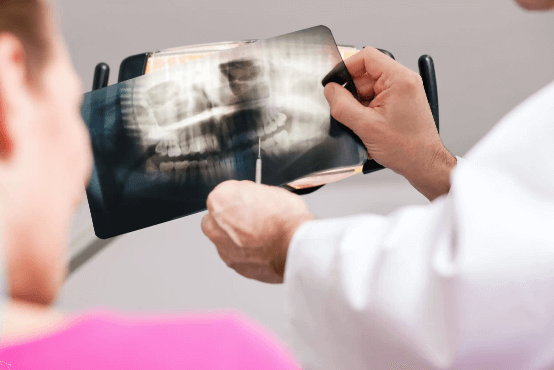 Digital X Rays