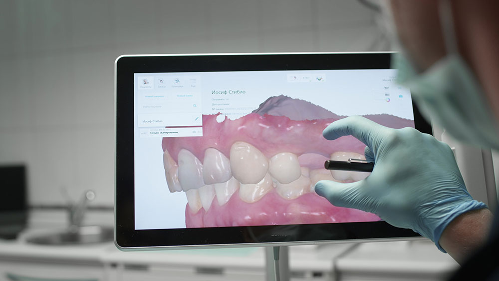 cbct dental implant scan