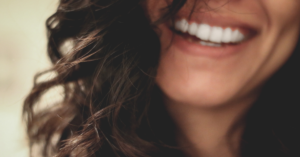 What Are Dental Veneers And How Do They Work?